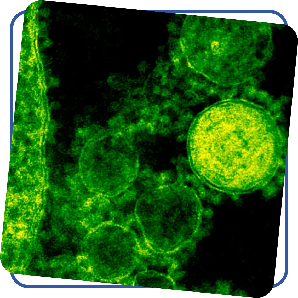 Microbiological and Chemical Analysis
